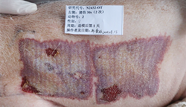 深II度燙傷模型